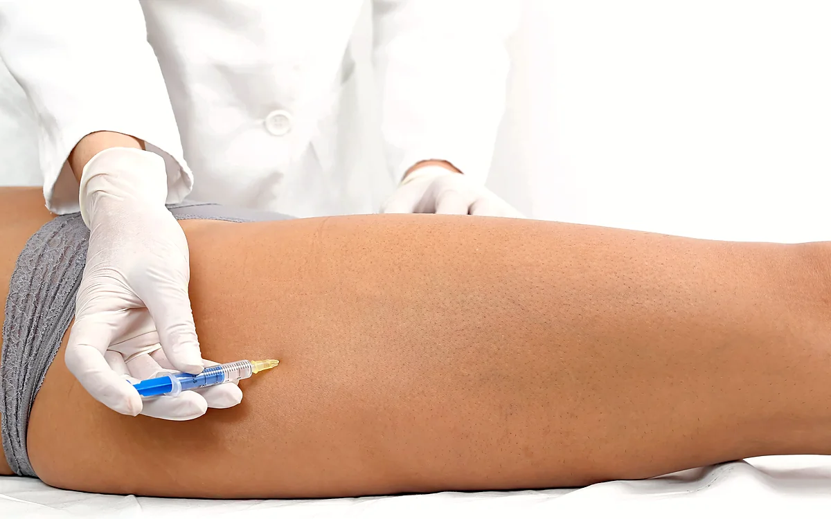 Mesoterapia